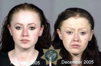 Before And After Meth
